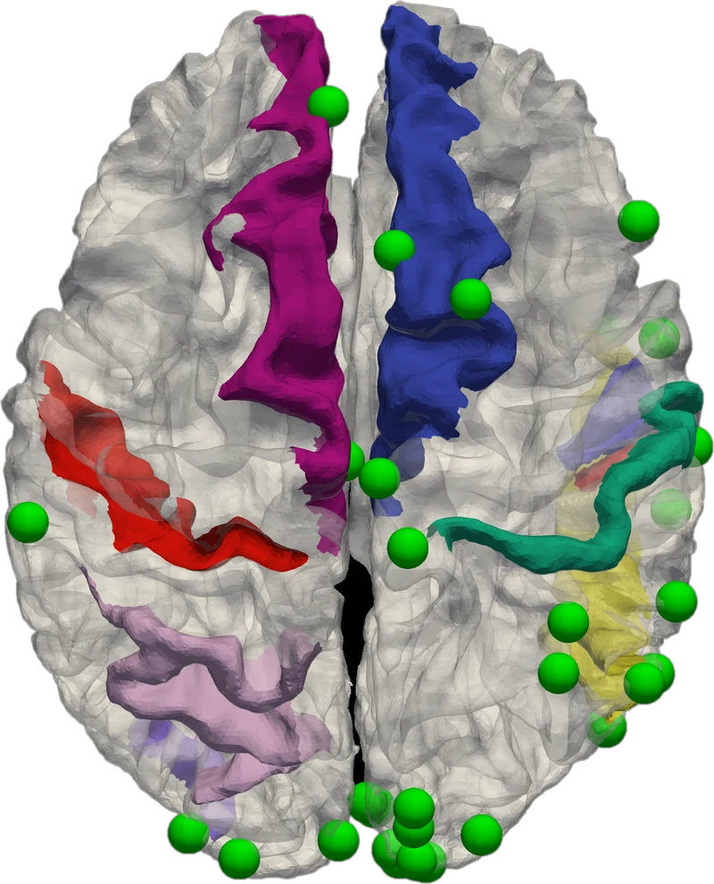 Superior view of 3HG landmarks and atlas regions